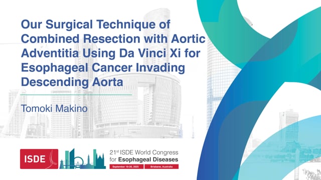 Our Surgical Technique of Combined Resection with Aortic Adventitia Using Da Vinci Xi for Esophageal Cancer Invading Descending Aorta – Tomoki Makino